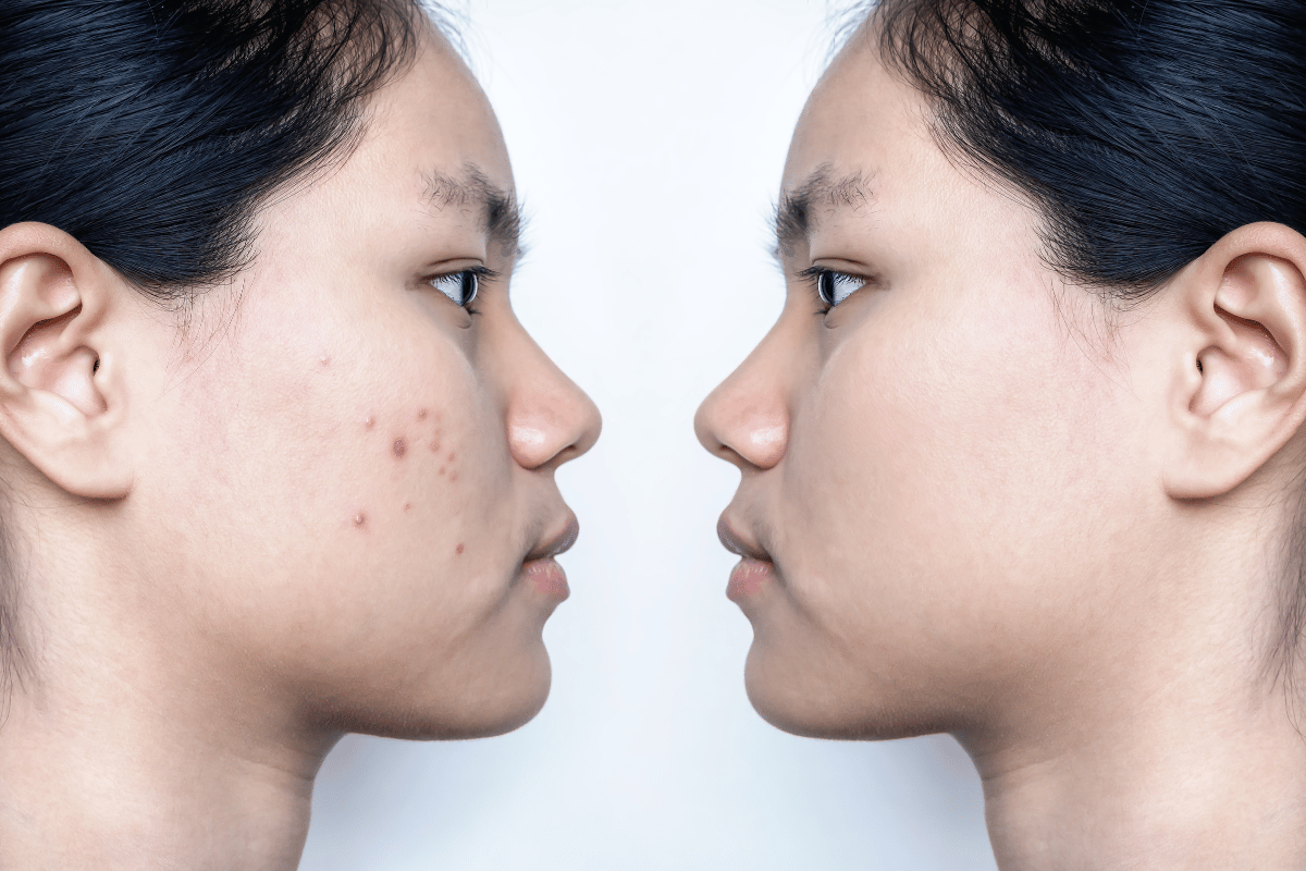 Preventing Irritated Skin Tags: A Guide to Healthy Skin Care Habits